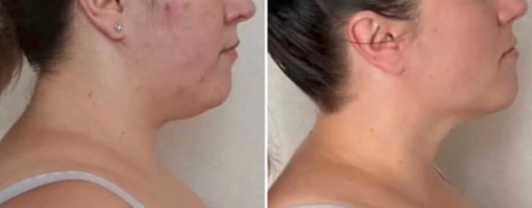 Transformación masaje facial